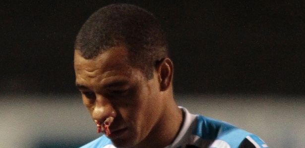 Gilberto Silva machucou o nariz durante o jogo contra o Avenida e teve de sair