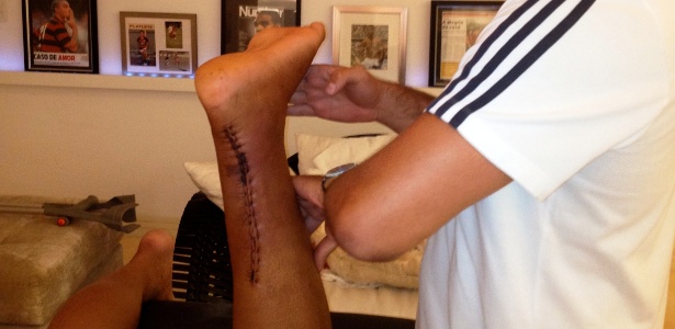 Adriano realiza primeira sessão de fisioterapia após cirurgia no tendão do pé esquerdo