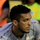 Carpegiani perde Douglas e ter&aacute; de escalar revela&ccedil;&atilde;o de 19 anos no gol do Vit&oacute;ria