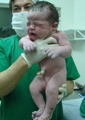 O bebê de 5,2 kg nasceu saudável, mas está em observação na UTI do hospital Santa Genoveva