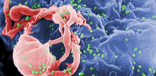 Célula infectada pelo HIV: nova pílula ajuda a interromper replicação do vírus
