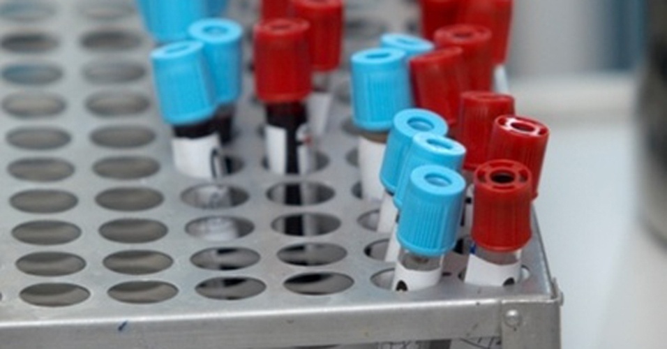 Dieta para exame de sangue oculto