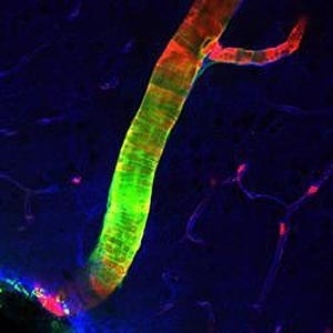Imagem mostra uma artéria no cérebro de um rato; a parte verde é o líquido cefalorraquidiano 