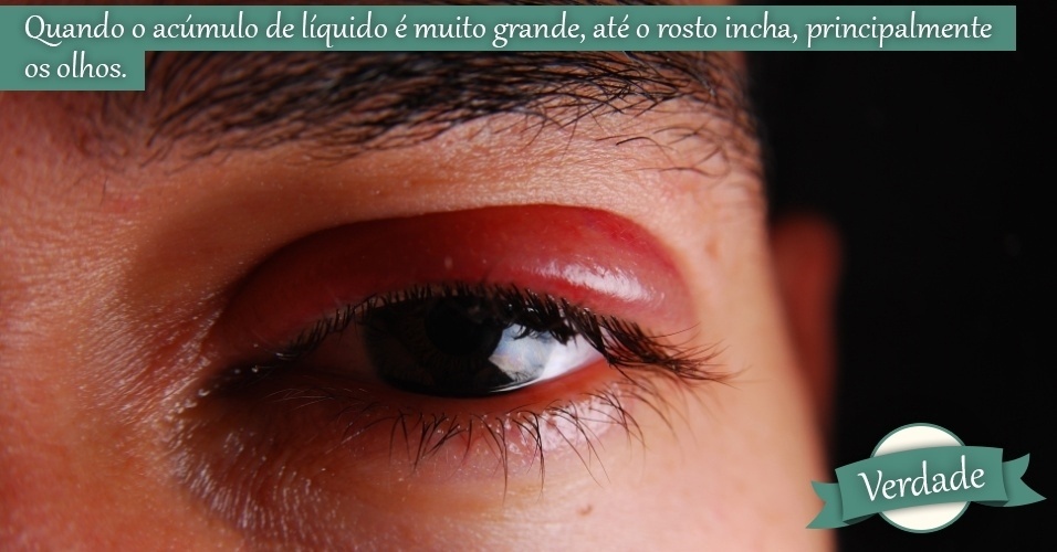 As máscaras ficam em frente do cuidado depois 40
