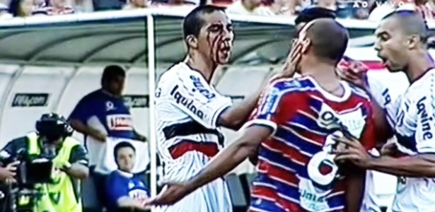 Jogador do Santa Cruz esfrega seu sangue no rosto de rival do Fortaleza 