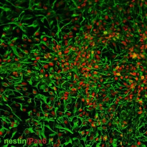 Células progenitoras neurais derivadas de urina humana