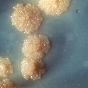 Imagem mostra cultura de bacilos causadores da tuberculose; cresce o número de relatos sobre resistência a antibióticos nas cepas da doença