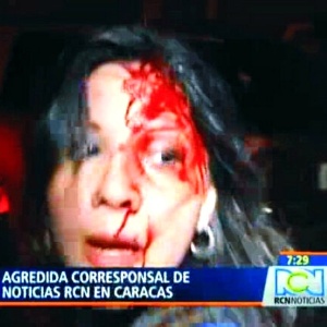 5mar2013---jornalista-carmen-andrea-rengifo-correspondente-da-emissora-de-tv-colombiana-rcn-na-venezuela-foi-agredida-em-caracas-na-noite-desta-terca-feira-5-enquanto-fazia-a-cobertura-da-morte-1362538723316_300x300.jpg