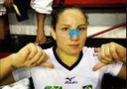 Vaidosas, mulheres do esporte usam artimanhas para esconder roxos e machucados