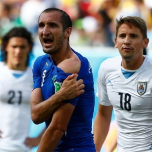 Giorgio Chiellini, da Itália, mostra marca de mordida de Luis Suárez, do Uruguai, em partida na Copa do Mundo