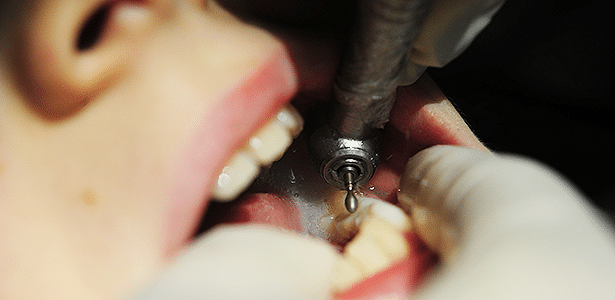 Motor 1.0 sempre foi apelidado de "motorzinho de dentista"; isso pode mudar