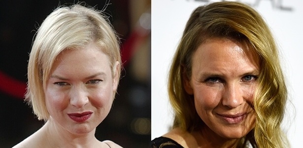 Antes e depois do rosto da atriz Renée Zellweger