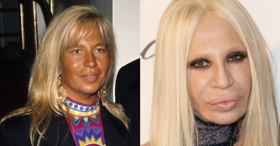 Fotos Antes E Depois Veja A Transforma O De Donatella Versace Uol Estilo De Vida