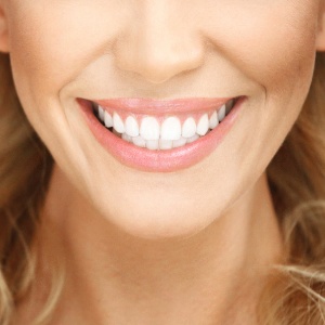 Clareamento dental, seja ele caseiro ou realizado em consultório, exige cuidados