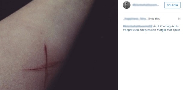 Adolescentes compartilham no Instagram fotos de automutilação
