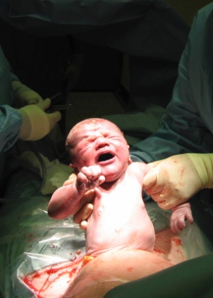 Getty Images Bactérias da mãe fortalecem bebê