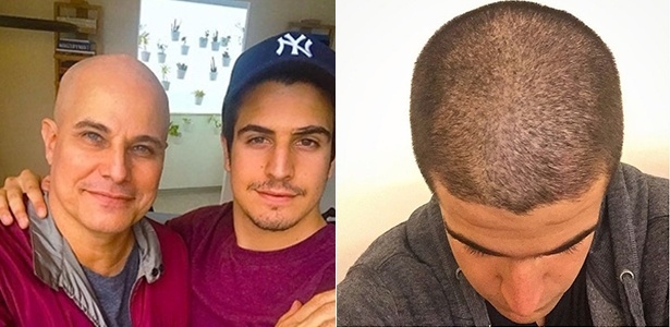 Enzo Celulari raspa o cabelo em homenagem ao pai, Edson Celulari, que luta contra o câncer