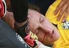 Scott Heavey/Getty Images