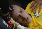 David Luiz deixa estádio com suspeita de fratura no nariz