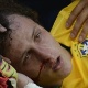 David Luiz deixa est&aacute;dio com suspeita de fratura no nariz