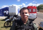  PM ferido em protesto poupa manifestantes e critica 