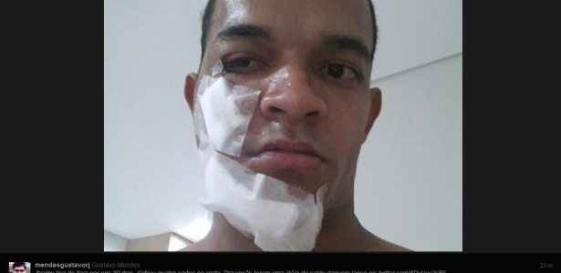 Atacante Jheimy, do Oeste, sofreu fratura no rosto e passará por cirurgia ao voltar a SP