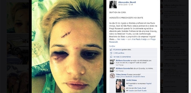 Ana Paula Araújo mostra ferimentos no rosto após ser agredida na praça Roosevelt