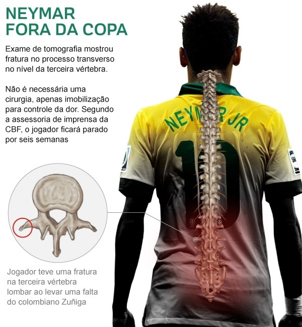 Cirurgião ortopedista fala de sua parceria com o Instituto Neymar Jr e  destaca a importância da camiseta postural – Jack Comunica