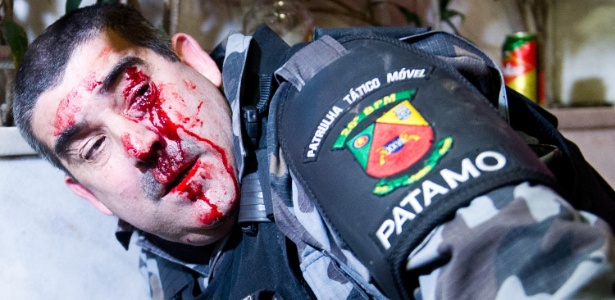 O sargento da Brigada Militar Elso Teixeira foi ferido em Porto Alegre durante ação de vândalos ao final da manifestação da quinta-feira (27)