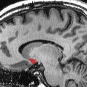 Estímulo cerebral provocado por orgasmos traz vários benefícios, segundo Komisaruk