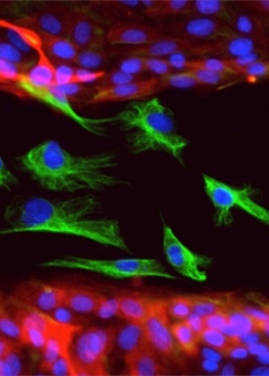 30.out,2013 - Células epiteliais (em vermelho) e mesenquimais (verde): as primeiras não são capazes de migrar como as segundas