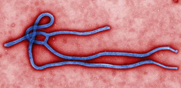 24.mar.2014 - Micrografia eletrônica colorida de transmissão revela um pouco da morfologia ultraestrutural exibida por uma partícula viral do vírus Ebola