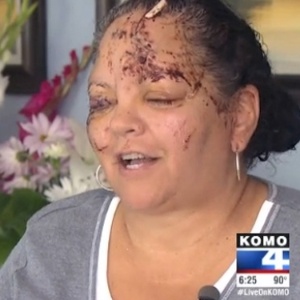 Lelani Grove contou que as mordidas da lontra pareciam ''pequenas facadas''. Ela levou cem pontos no rosto e ficou com uma ferida no olho direito