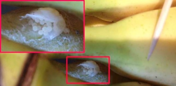Reprodução/Cascade News/Metro No detalhe da foto, os ovos de uma aranha brasileira armadeira, considerada a mais letal do mundo, encontrados em um cacho de bananas comprado no Reino Unido