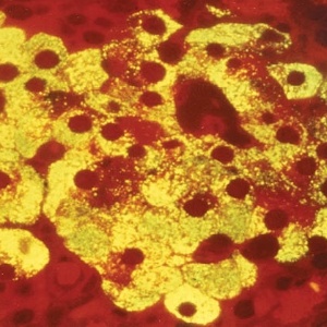 Células do pâncreas produtoras de insulina (em amarelo)