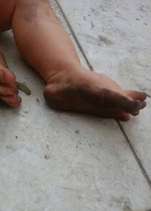 Criança suja os pés com o pó preto que as indústrias de Vitória (ES) soltam no ar