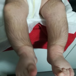 Reprodução/Dermatologic Therapy