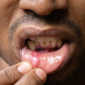 iStock