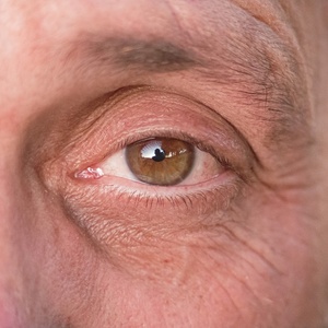 4 problemas comuns de visão após os 60 anos e como se prevenir