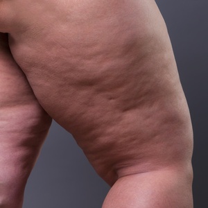 iStock