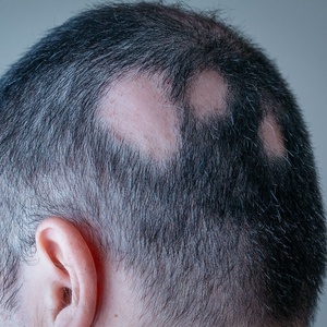 iStock