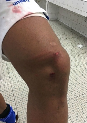 Cruzeiro exibe joelho machucado de Ábila após lance com Cássio