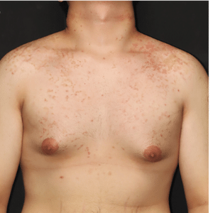 The New England Journal of Medicine 