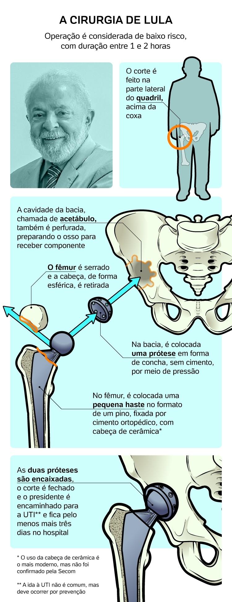 Pós-cirúrgico de Lula pulveriza poder e emperra articulação do