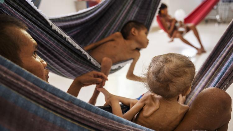 Crianças yanomami internadas com desnutrição em hospital de Boa Vista
